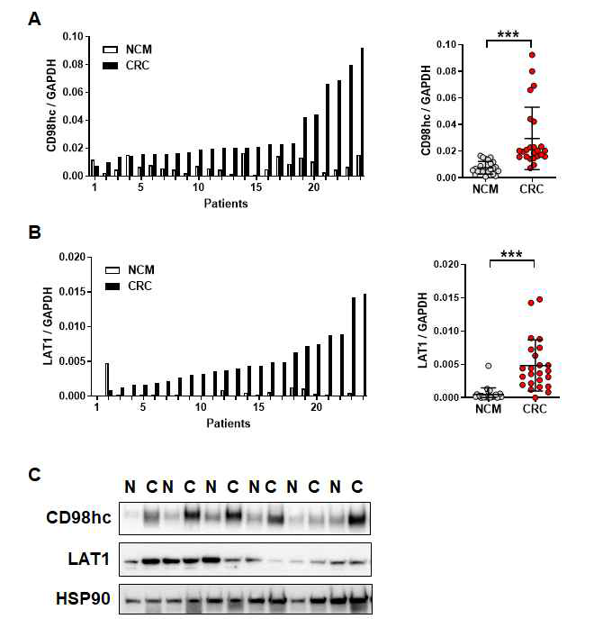 mRNA expression of CD98 heavy chain (CD98hc) and LAT1 in human colorectal cancer (CRC) samples. Real-time PCR analysis of the expression of CD98hc (A) and LAT1 (B) from 24 pairs of fresh-frozen CRC samples and matched non-cancerous mucosa (NCM). CD98hc and LAT1 expression level was significantly higher in CRCs than in NCM. © Immunoblot for CD98hc and LAT1 in 6 pairs of colorectal cancer and corresponding normal mucosa tissues. Data are presented as the mean ± SEM. SEM: standard error of the mean. ***P < 0.001. N, normal mucosa; C, colorectal cancer tissues