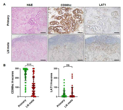 Upregulated expression of CD98 heavy chain (CD98hc) and LAT1 during adenoma to carcinoma transformation (n = 21). (A) Representative images of CD98hc and LAT1 expression in a colorectal cancer arising within an adenoma background, in which CD98hc and LAT1 expression increased in carcinoma region than in pre-existing adenoma region. (B) Histo-scores of CD98hc and LAT1 significantly increased in carcinoma areas. Data are presented as the mean ± SEM. SEM: standard error of the mean. ***P < 0.001