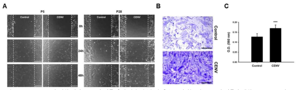 iPSC-CENV에 의한 인간 HDFs의 이동 촉진. (A) 젊은(P5) 혹은 노화된(P28) HDFs의 이동에 대한 iPSC-CENV의 효과를 보여주는 scratch wound assay 결과. iPSC-CENV 처리한 경우, wound 지역(점선 안쪽)으로 이동해 온 세포의 수가 증가하였음. (B) iPSC-CENV의 처리에 의해 노화된 HDFs의 이동이 촉진됨을 보여주는 transwell-migration assay 및 이에 대한 (C) 정량 분석 결과