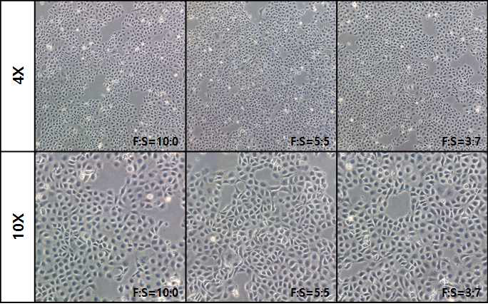 Ps-5세대의 SACCS 적응 CHSE-214 세포주의 morphology