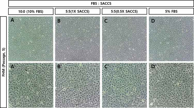 Ps-5세대의 SACCS 적응 FHM 세포주의 morphology