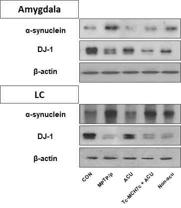 파킨슨병 모델의 Amygdala와 LC에서 alpha-synuclein과 DJ-1 발현의 변화