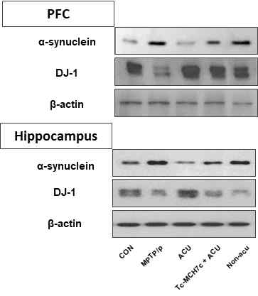 파킨슨병 모델의 PFC와 hippocampus에서 alpha-synuclein과 DJ-1 발현의 변화