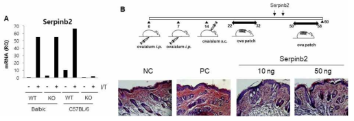 MSC에서 serpinb2 발현 및 serpinb2의 아토피피부염 치료효능 분석. (A) MSC에서 serpinb2 mRNA, (B) serpinb2 주입 후 아토피피부염 치료효능 분석