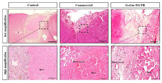 Gel/mTG 하이드로젤 적용 2주 후 동물 조직병리학적 평가