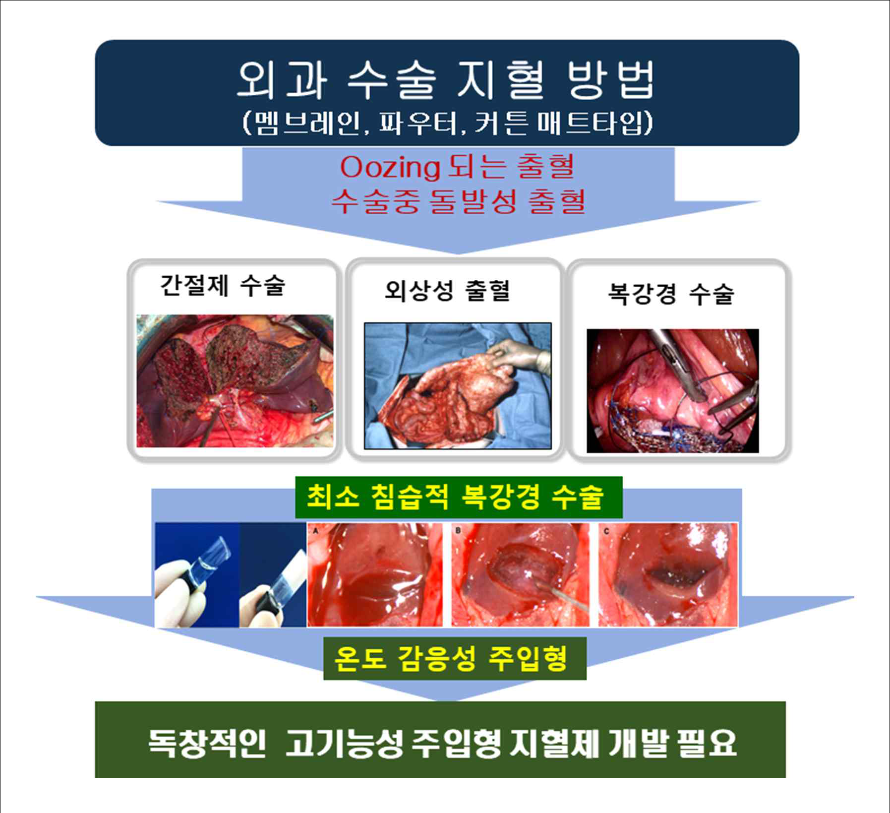 외과수술 지혈방법