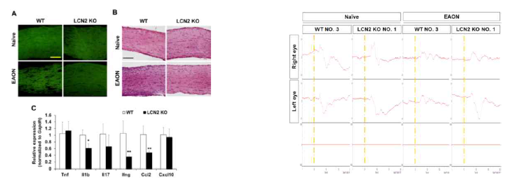 LCN2가 KO된 시신경염 마우스에서의 신경손상 보호 효과. 왼쪽 그림: 탈수초현상과 림프구 유입 및 M1 관련 유전자가 LCN2 KO 마우스에서 감소되었음. 오른쪽 그림: VEP를 통해 시신경 손상이 적게 발생한 것을 확인하였음