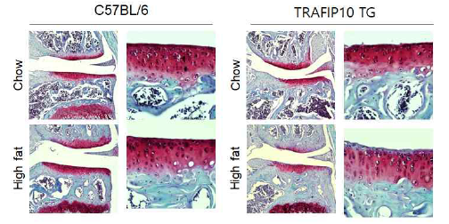 비만유도시 TRAFIP10 TG 마우스에서의 관절손상