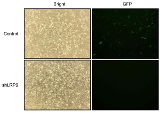 shLRP6 3T3-L1 형질변환 세포주 구축