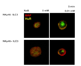 Group 3 ILCs에서 RNA binding protein BRF-2의 발현을 관찰함