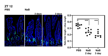 gut epithelial cell의 증식을 Edu로 관찰