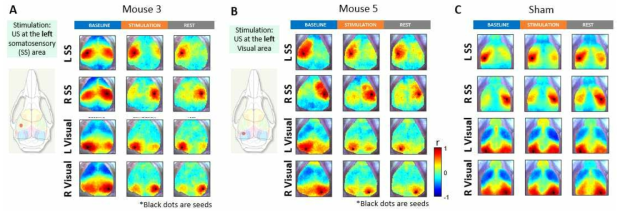 초음파 뇌자극에 따른 뇌기능연결성 맵의 변화 A: somatosensory 영역에 초음파 자극을 준 경우, B: 왼쪽 visual cortex에 초음파 자극을 준 경우, C: A, B와 같은 셋업이나 실질적인 초음파 자극을 주지 않은 경우