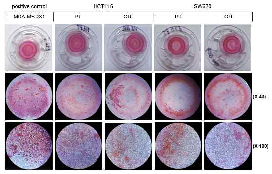 Transwell assay를 이용하여 HCT116 및 SW620 세포에서 oxaliplatin에 내성발현이 세포 침윤성에 미치는 영향. MDA-MB-231 cell은 양성 대조군임