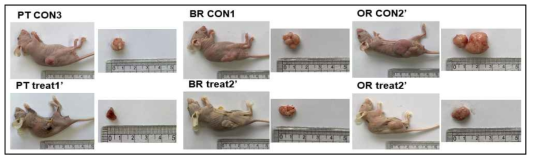 HCT116/PT 및 HCT116/OR 대장암 세포 xenograft nude mouse model의 종양 크기