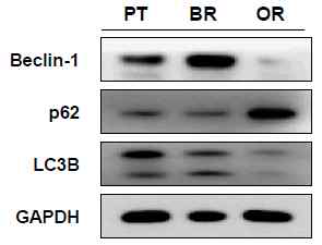 HCT116 xenograft 모델 (PT, BR, OR)에서 autophagy에 관여하는 단백질 발현 변화