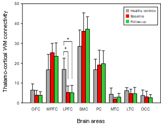 세 그룹에서 서로 다른 thalamo-cortical connectivity. AD 환자는 정상인에 비해 thalamo-LPFC connectivity가 감소함
