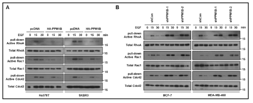 PPM1B에 의한 RhoGTPase 활성 억제 규명
