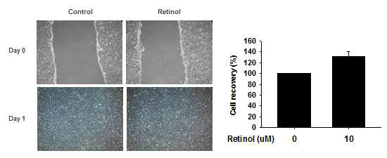 레티놀 처리에 따른 세포의 증식 관찰. C2C12 세포에 100% 성장하였을 때 스크래치를 가하고 레티놀을 처리한 후 1일 동안 배양하였음. 배양 1일 후 세포의 회복정도를 측정한 후 처리하지 않은 세포의 회복력 값을 100으로 두고 처리한 세포의 상댓값을 계산하였음. (Control은 아무것도 처리하지 않은 세포를 나타냄)