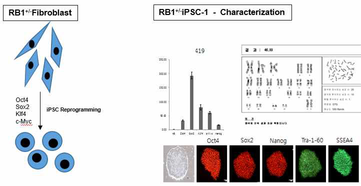 유전성 망막모세포종 환자 유래 유도만능 줄기세포 수립 (RB1+/-iPSC-1 cell line)