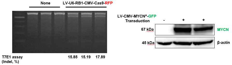 RB1 에 발생한 INDEL 과 MYCN 단백의 증가된 발현을 확인 (unpublised data)