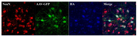 형광면역염색법을 이용하여 AAV-GFP의 신경세포 delivery를 확인