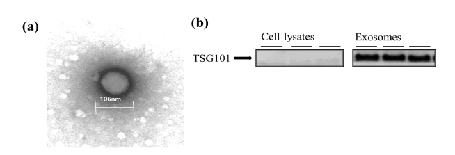 (a) RAW 264.7 엑소좀의 TEM 사진. (b) TSG101 단백질을 확인한 RAW 264.7세포 용해물(좌)과 엑소좀(우)의 웨스턴 블랏