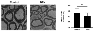 대조군과 DPN 모델 실험군 간의 myelin sheath 두께 비교