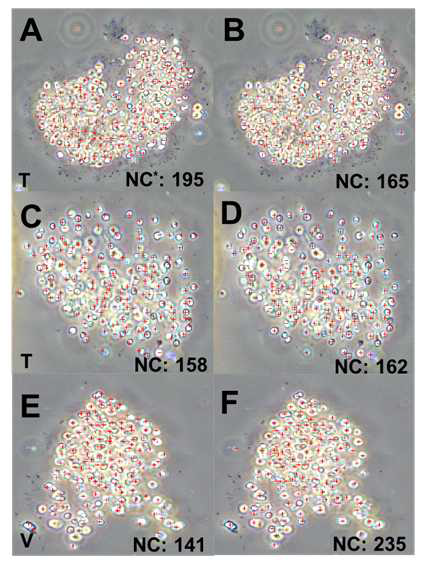 Microcystis aeruginosa의 cell counting 모델 학습결과