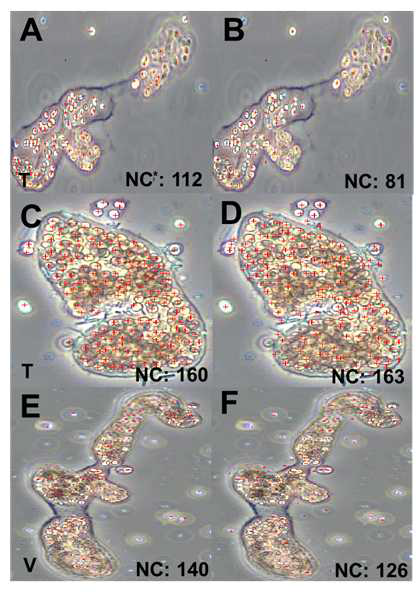 Microcystis wesenbergii의 Cell counting 모델 학습결과