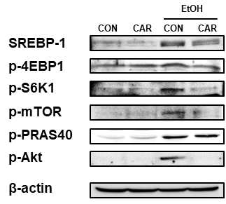 알코올과 Carvacrol 투여 여부에 따른 간 내 지방합성효소 유도 신호전달체계 단백질들의 비교