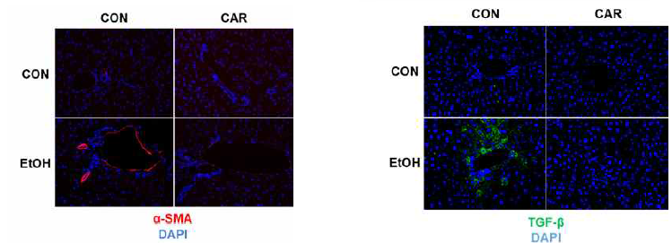 알코올과 Carvacrol 투여 여부에 따른 활성화된 간 성상세포 비교