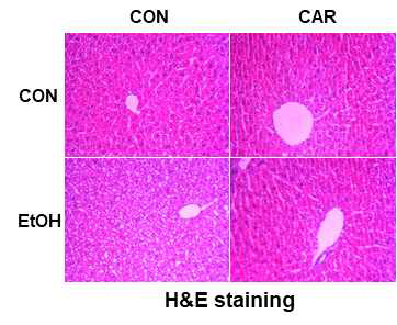 알코올과 Carvacrol 투여 여부에 따른 간의 조직학적 차이