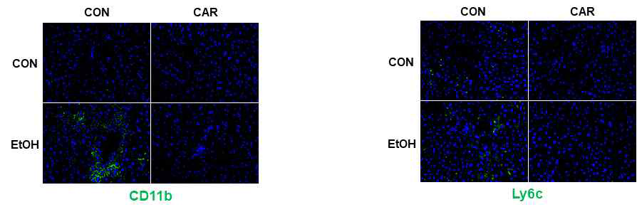 알코올과 Carvacrol 투여 여부에 따른 간 조직 내 면역세포 축적의 조직학적 차이