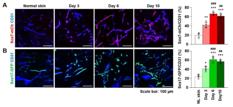 정상 피부조직과 창상조직의 Sox7 및 Sox17 발현 비교