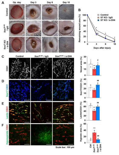 Sox7 결손에 의한 난치성 창상에 Dll4 항체 주입의 효과