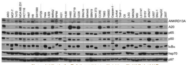 다양한 암 세포주에서 ANKRD13a 및 PCD 조절인자들의 발현률