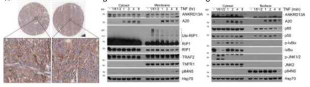 ANKRD13a의 암 조직 및 세포내 분포