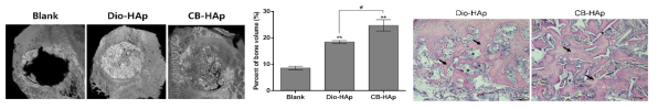 Micro-CT에 의한 3차원 이미지와 신생골의 Persent of bone volume 및 Hematoxylin-eosin 조직염색 (#P < 0.05, **,##P < 0.01)