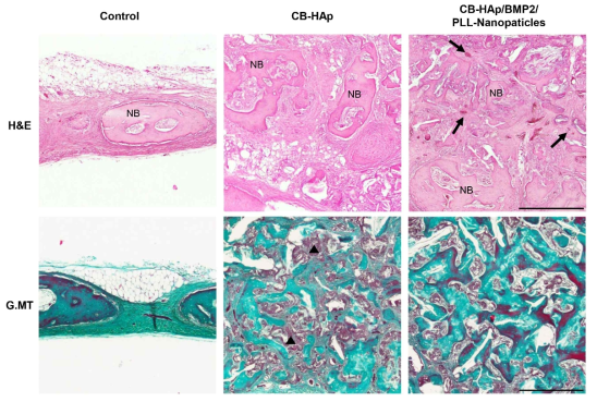 토끼 두개골 모델을 통한 hematoxylin-eosin stain 및 Goldner’s trichrome stain