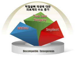 턱뼈 재생에 대한 의료계의 수요 증가