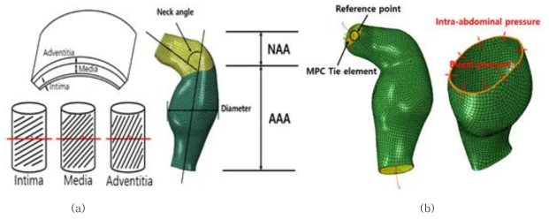 (a) 대동맥 벽 각 층의 섬유방향과 구분된 모델과 (b) MPC constraint와 경계, 하중 조건