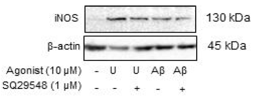 Investigation of Inducible nitric oxide synthase (iNOS) levels in U46619 (U) or amyloid β 25-35 (Aβ)-induced BV2 microglial cells. Cells were treated with SQ29548 for 1 h before U46619 or Aβ stimulation at 24 h incubation period. After treatment, the cells were washed, collected, and subjected to western blotting analysis with anti-iNOS antibody and β-actin antibody, respectively