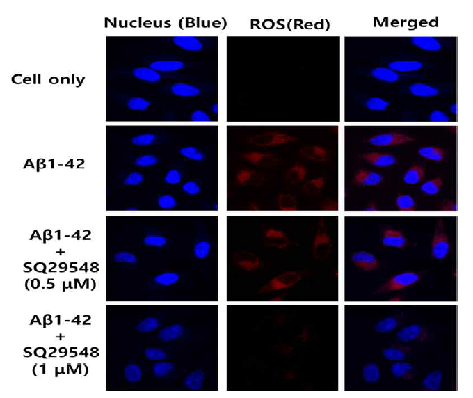 Anti-oxidant effect of SQ29548 in Aβ-induced HT22 cells