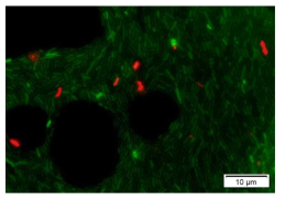 Image of Aeromonas sp. (red is dead cell and green is live cell)