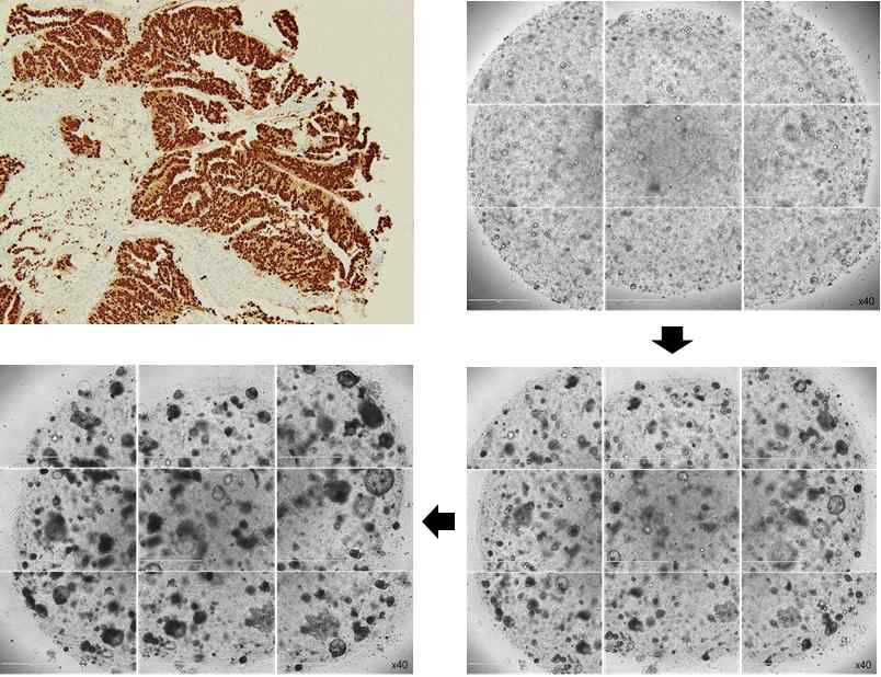 p53 mutation cancer의 경우 nutlin-3 처치 후 normal 은 제거되고 tumoroid로만 채워짐