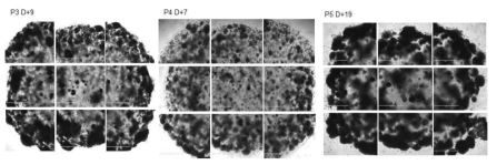 mechanical selection이후 P4 부터는 추가적 pick out 없이 tumoroid로만 자람. signet ring cell carcinoma tumoroid 임