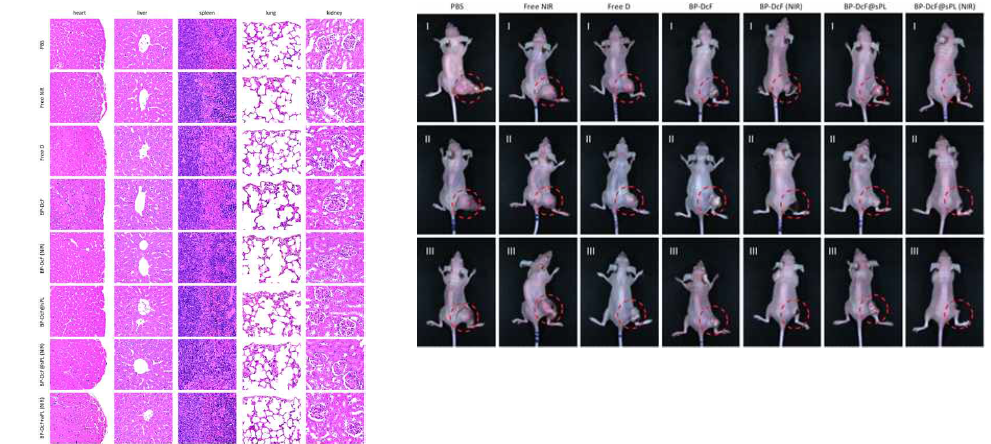 (A) Histopathological observations in heart, liver, spleen, lungs, and kidneys collected from mice treated with BP-DcF and BP-DcF@sPL in the absence and presence of NIR irradiation, including individual PBS, NIR, and D with BP-DcF+aPL (in the presence of NIR) for comparison purposes. (B) Digital images of HCT116 tumor-bearing Balb/c nude mice treated with BP-DcF and BP-DcF@sPL in the absence and presence of NIR irradiation, including individual PBS, NIR, and D for comparison purposes