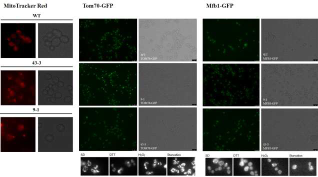 Peroxisome 조절 효모의 mitochondria morphology 변화