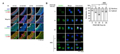 CIAPIN1의 핵내로의 이동(translocation)의 관찰