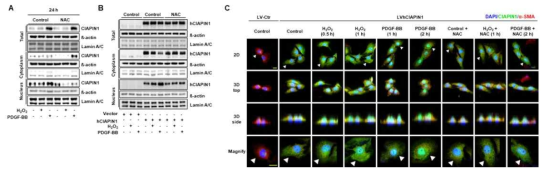 CIAPIN1의 핵내로의 이동(translocation)에 따른 활성 산소(reactive oxygen species) 역할 규명